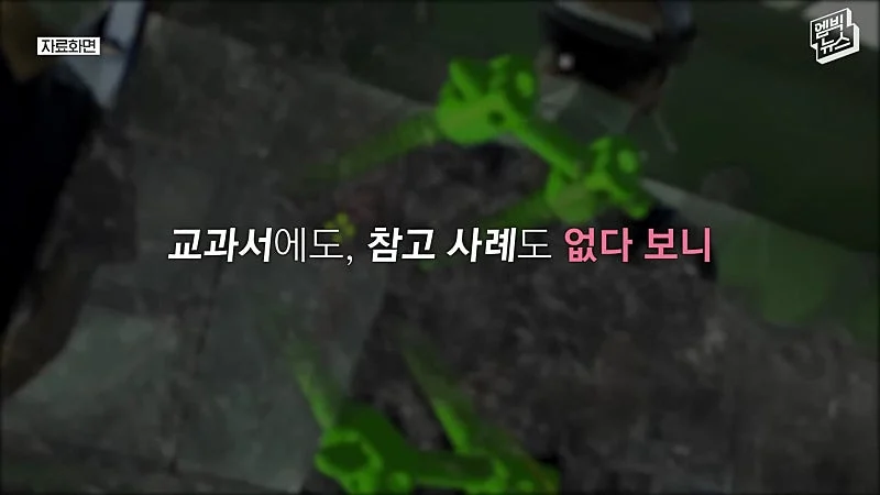 33시간 수술 끝에 얼굴 본 쌍둥이 (36)