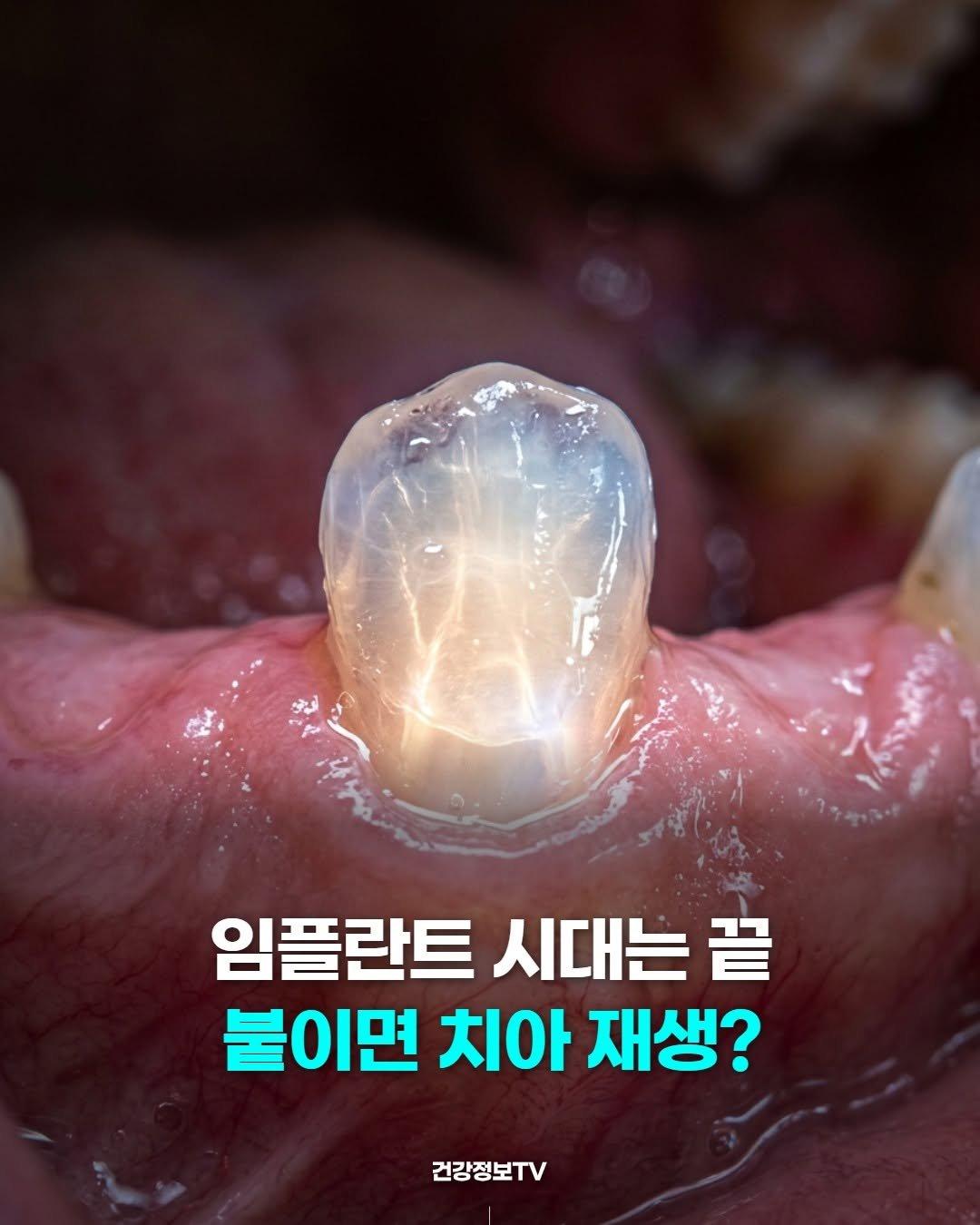 또 사고친 국내 연구진 소식
