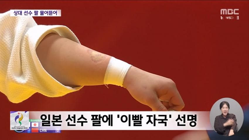 kbs) 유도하다 '물어뜯기'...중국 '황당' 실격패 (16)