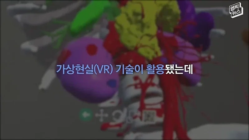33시간 수술 끝에 얼굴 본 쌍둥이 (37)