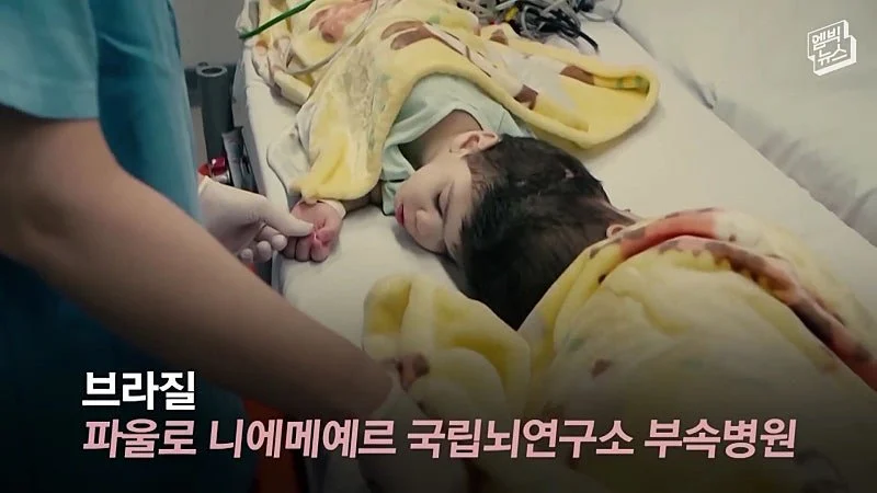 33시간 수술 끝에 얼굴 본 쌍둥이 (8)