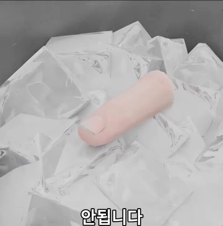 싱글벙글 손가락이 잘렸을 때 대처법 (10)
