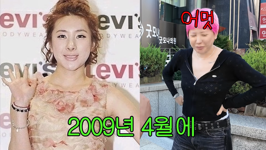 서인영이 말하는 코성형 역사 ㅋㅋㅋㅋㅋ (22)
