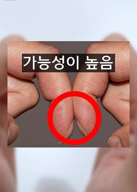 긴급) 지금 이동작 안되면 바로 병원에 가야 합니다! (9)