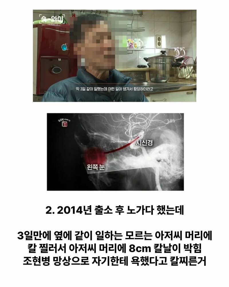 강력범죄 정신질환자들이 길거리에 돌아다니는 이유 (3)