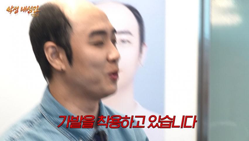 싱글벙글 21살부터 탈모였다는 올해 41살인 남자 사장 (3)