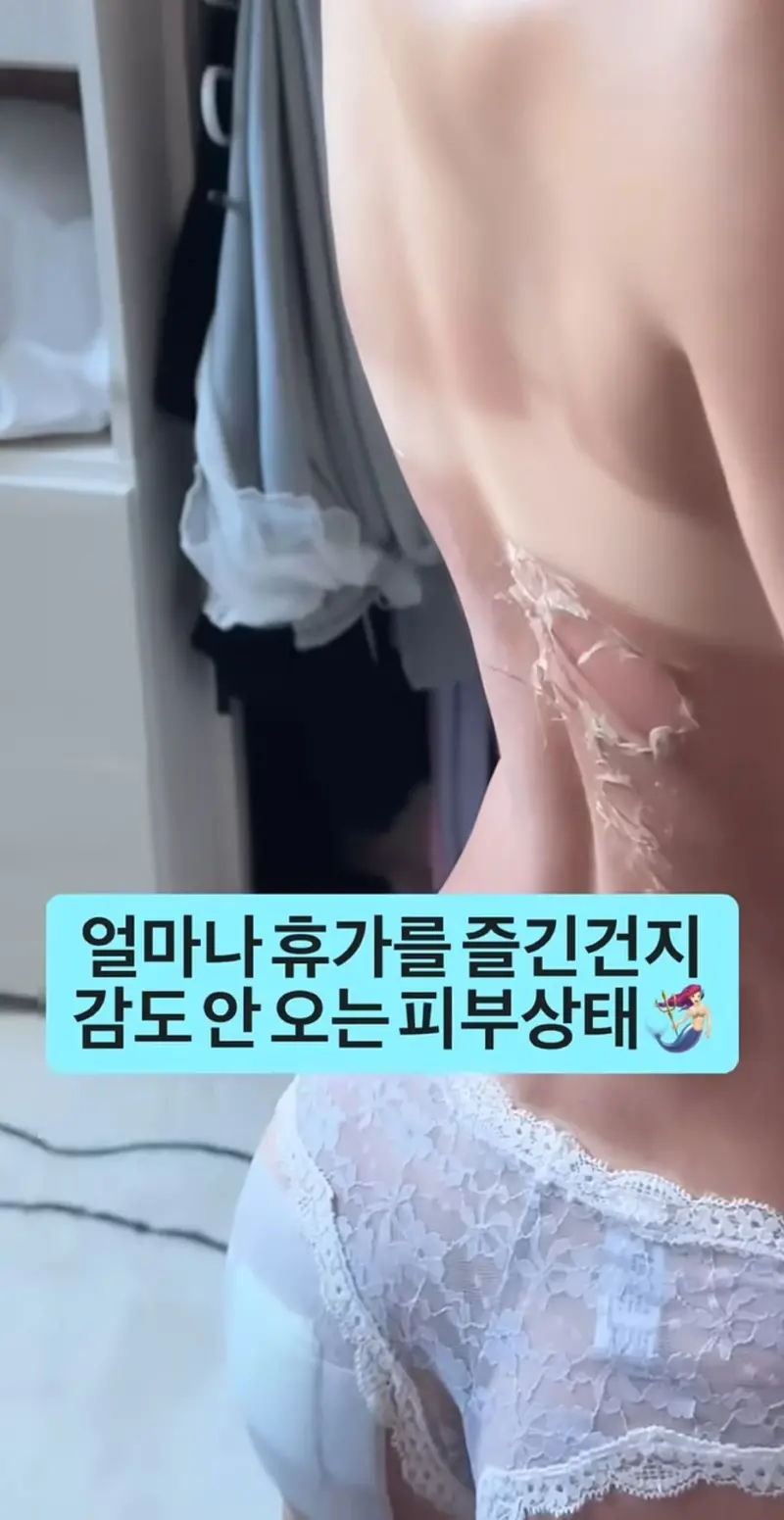 ㅇㅎ) 휴가 갔다 온 츠자의 피부 상태. (2)