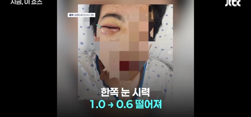 "졸업시켜 보디가드로 쓰면돼", 학폭 가해자 옹호한 교장 (2)