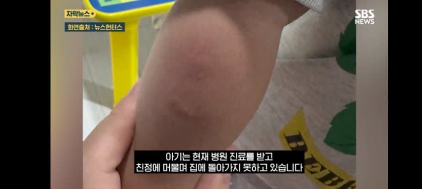 보관이사 맡겼다가 곰팡이, 벌레로 가구 다 망가진 제보자 (15)