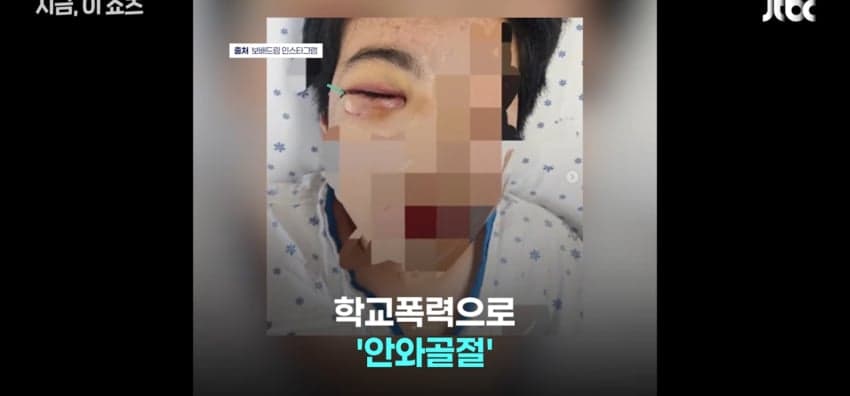 "졸업시켜 보디가드로 쓰면돼", 학폭 가해자 옹호한 교장
