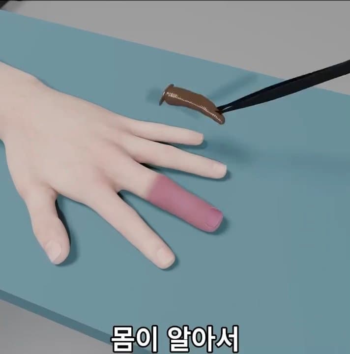 싱글벙글 손가락이 잘렸을 때 대처법 (48)