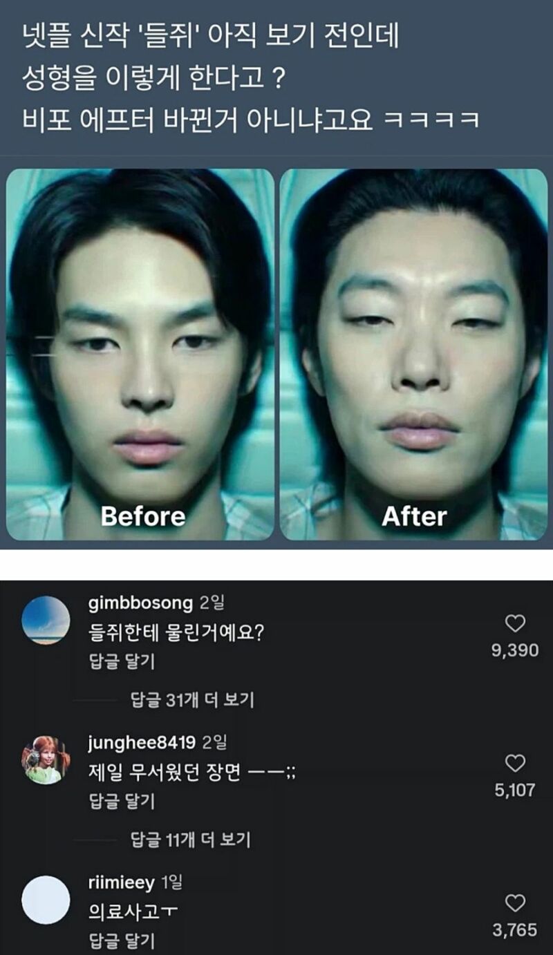 의료사고