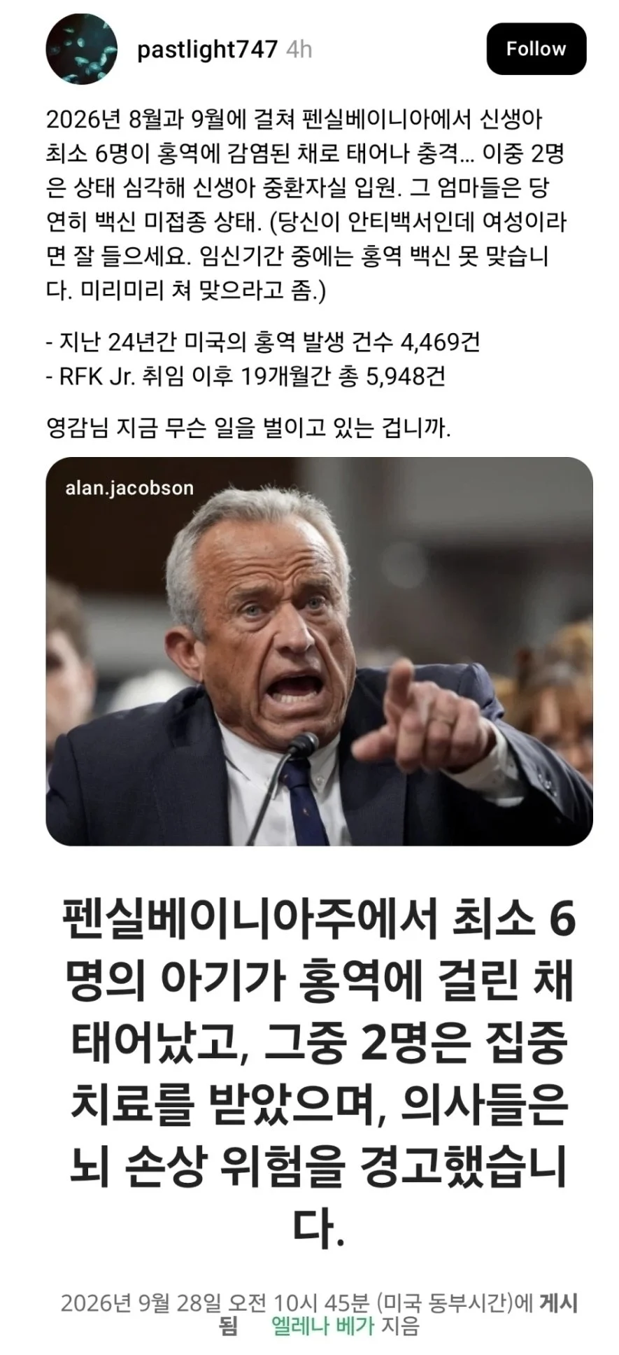 미국에서 신생아가 홍역에 걸린 채 태어남