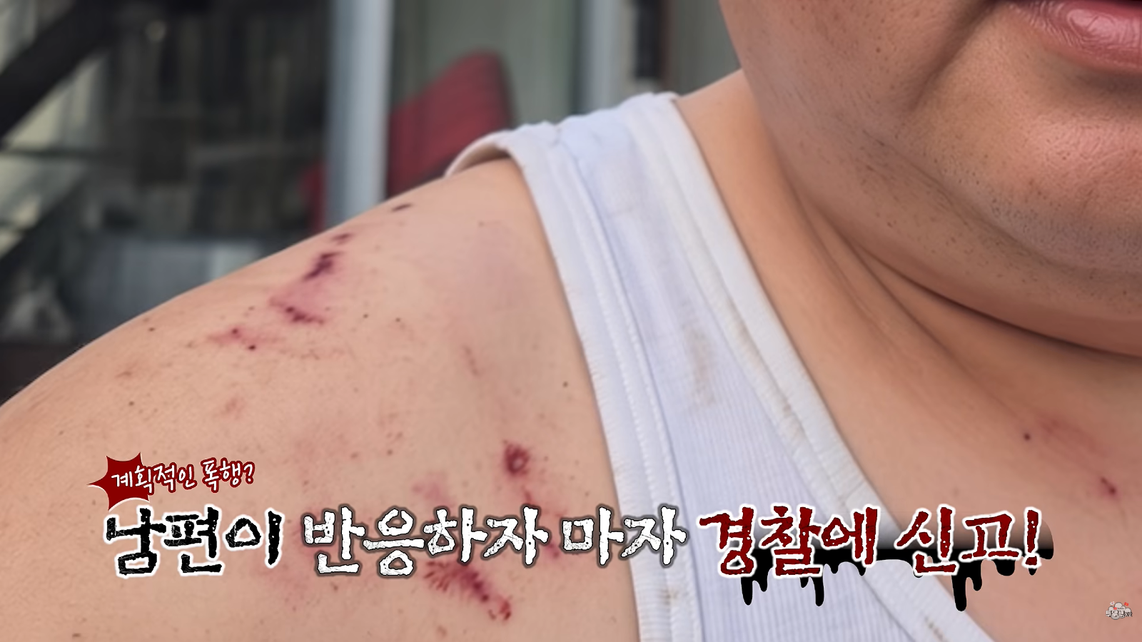 국제결혼 3달만에 남편 사망 (28)