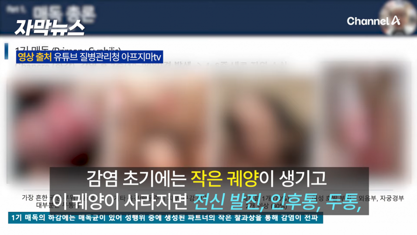 매독 감염자 확산, 한국 2030 남성 상당수(?) (14)