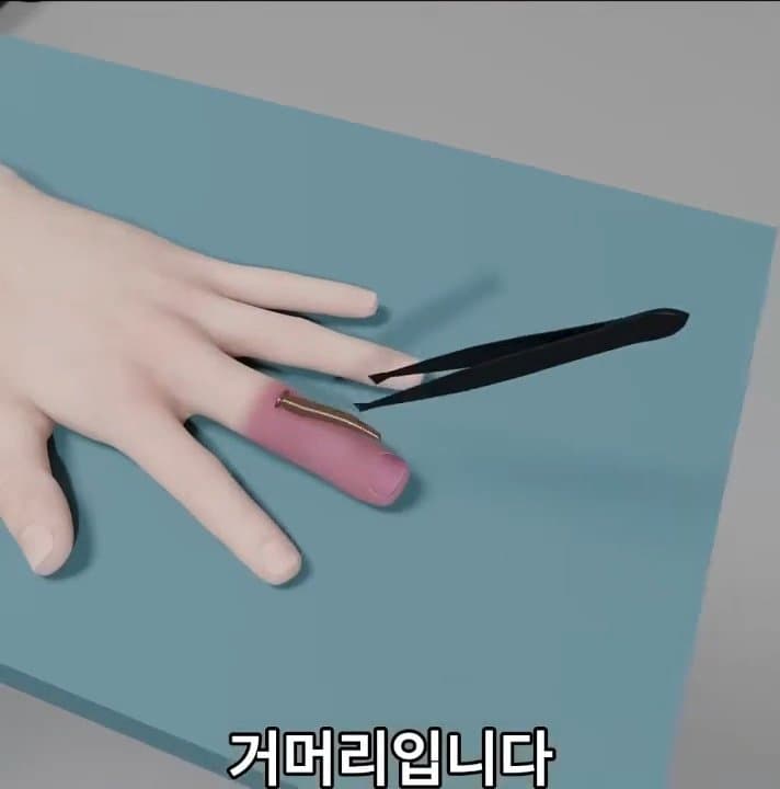 싱글벙글 손가락이 잘렸을 때 대처법 (45)