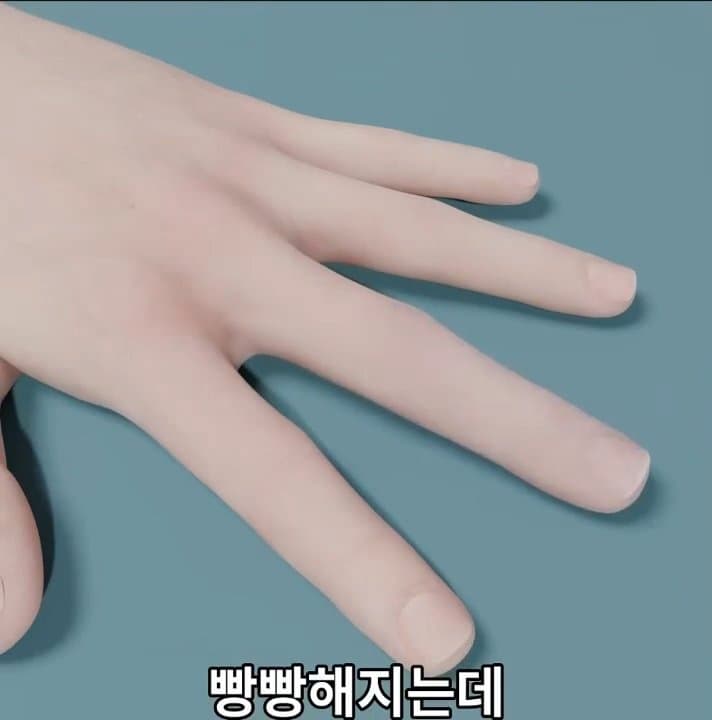 싱글벙글 손가락이 잘렸을 때 대처법 (41)