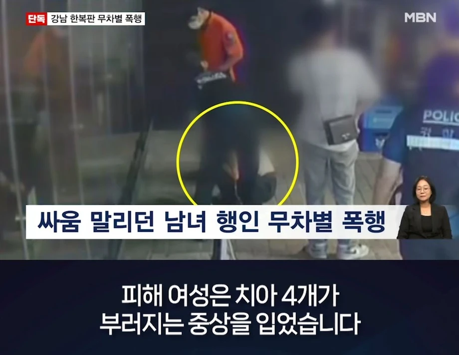 강남 여성 무차별 폭행한 20대 남성..치아 4개 부러져 (10)