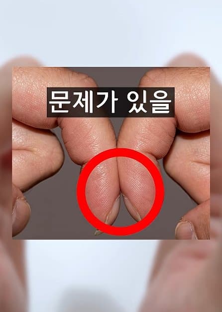 긴급) 지금 이동작 안되면 바로 병원에 가야 합니다! (8)