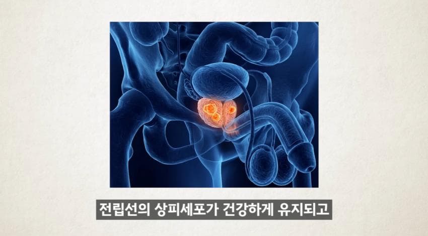 한달에 21번 사정하라 (34)
