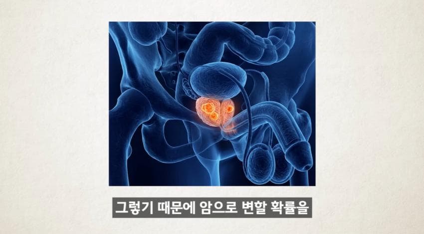 한달에 21번 사정하라 (35)