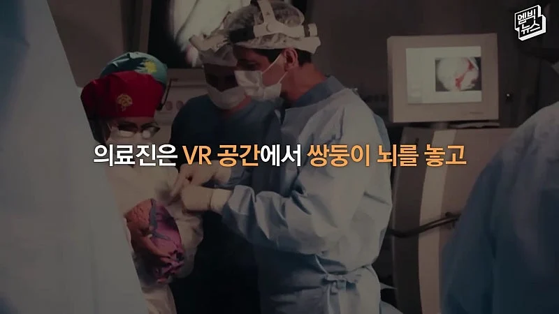 33시간 수술 끝에 얼굴 본 쌍둥이 (38)