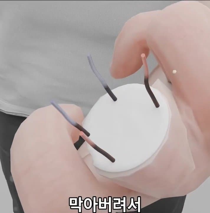 싱글벙글 손가락이 잘렸을 때 대처법 (21)