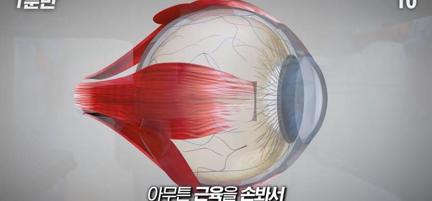 사시는 과연 어떻게 보일까...? (37)