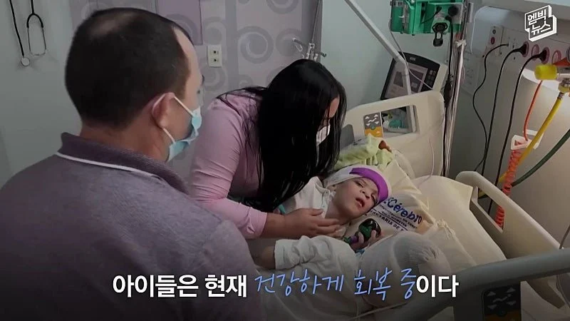 33시간 수술 끝에 얼굴 본 쌍둥이 (47)