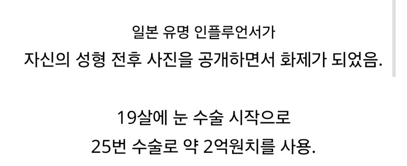 충격적인 2억원어치 성형결과.. (7)