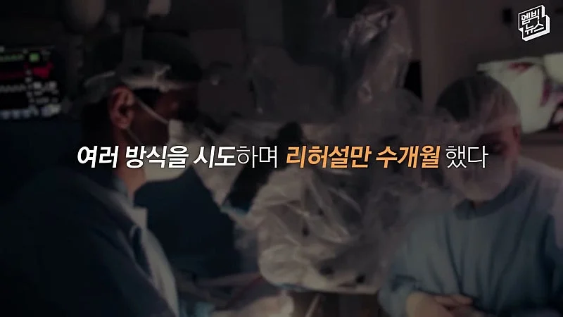 33시간 수술 끝에 얼굴 본 쌍둥이 (39)
