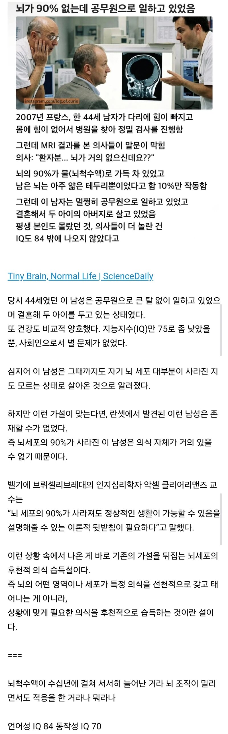 뇌의 90%가 없어졌는데 공무원으로 일하고 있었음.