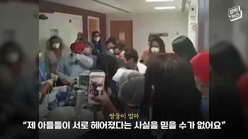 33시간 수술 끝에 얼굴 본 쌍둥이 (24)