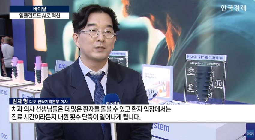 임플란트도 AI가 대세…수술 하루 만에 끝낸다 (10)