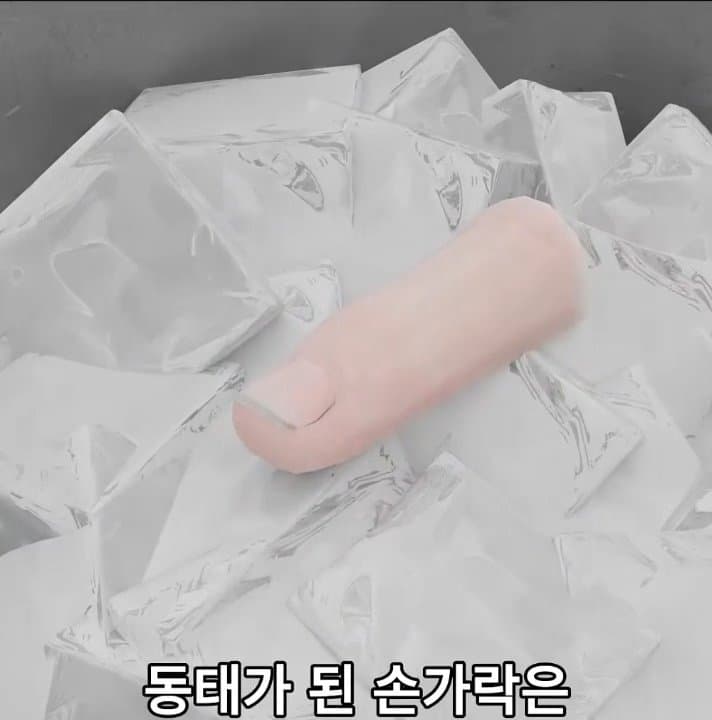 싱글벙글 손가락이 잘렸을 때 대처법 (11)