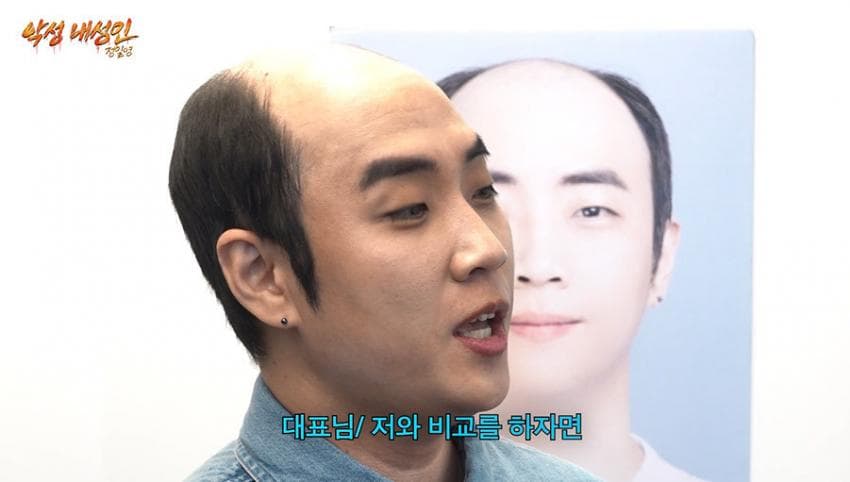 싱글벙글 21살부터 탈모였다는 올해 41살인 남자 사장 (7)