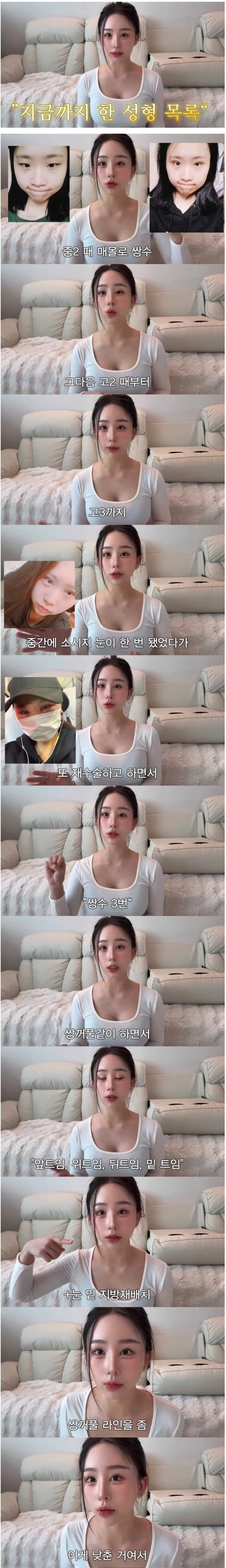 중2때부터 했던 성형 다 밝힌 유튜버 (3)