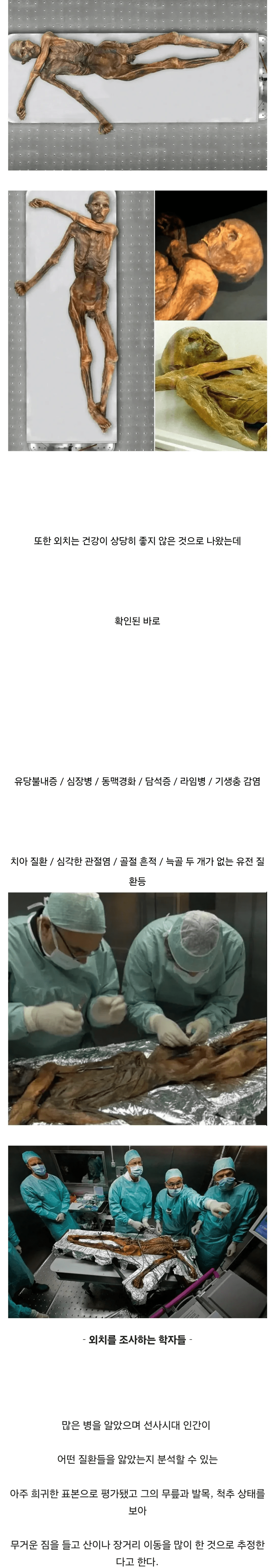 약혐?) 얼음 속에서 5000년 넘게 잠들어 있던 미라 이야기 (3)