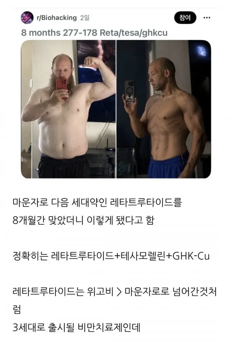 현재 난리난 차세대 비만치료제 (3)
