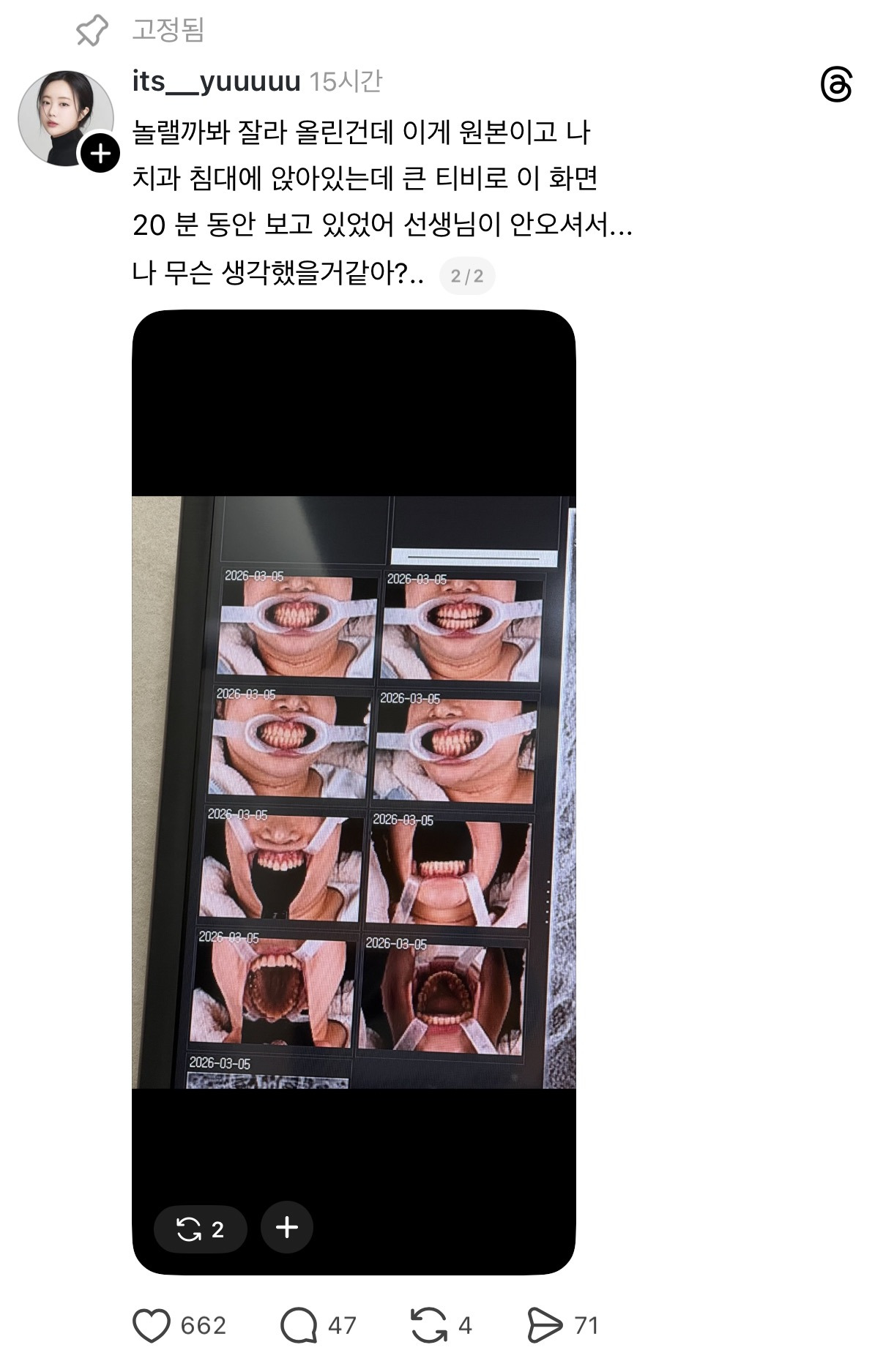 xuoYjX