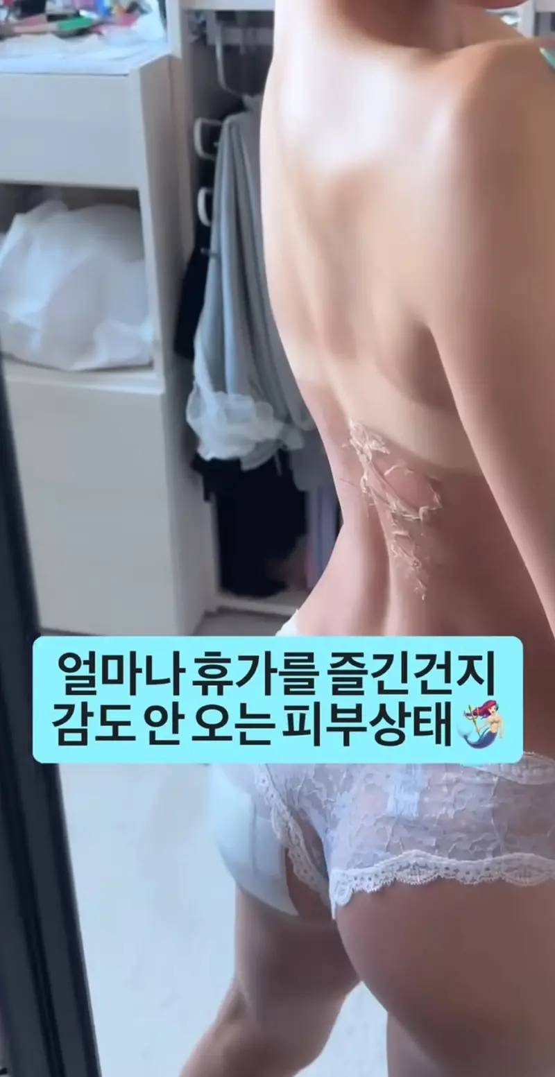 ㅇㅎ) 휴가 갔다 온 츠자의 피부 상태.