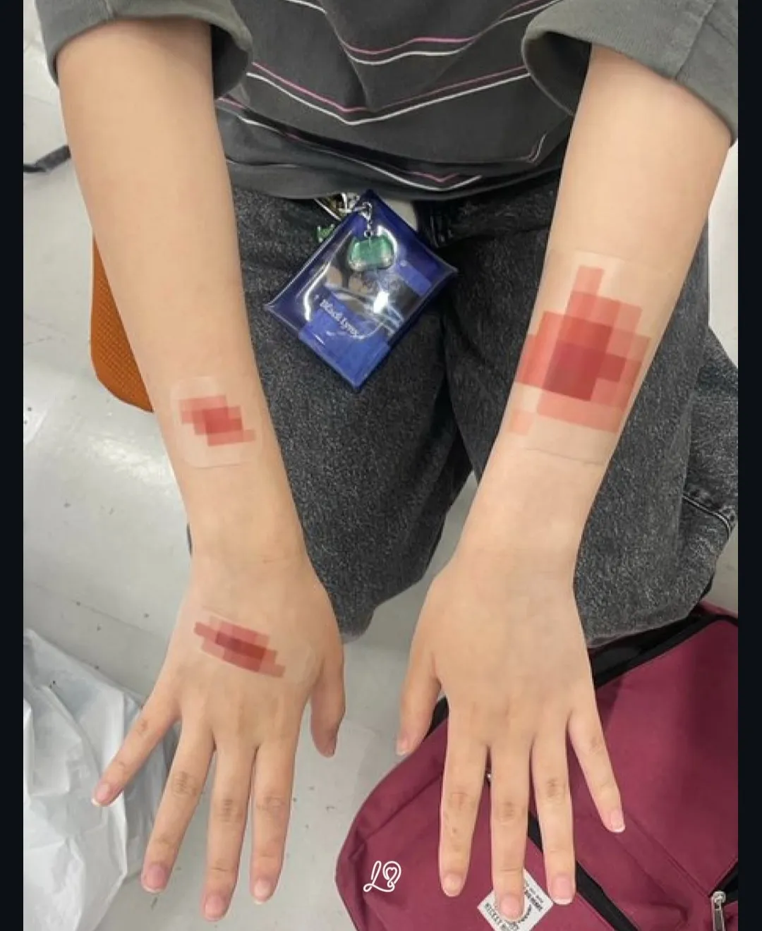 일본에서 화제라는 모자이크 반창고 (2)