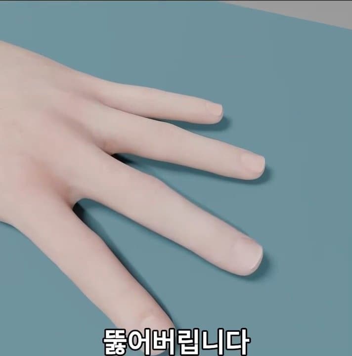 싱글벙글 손가락이 잘렸을 때 대처법 (50)