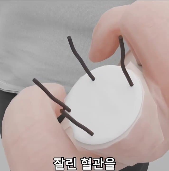 싱글벙글 손가락이 잘렸을 때 대처법 (22)