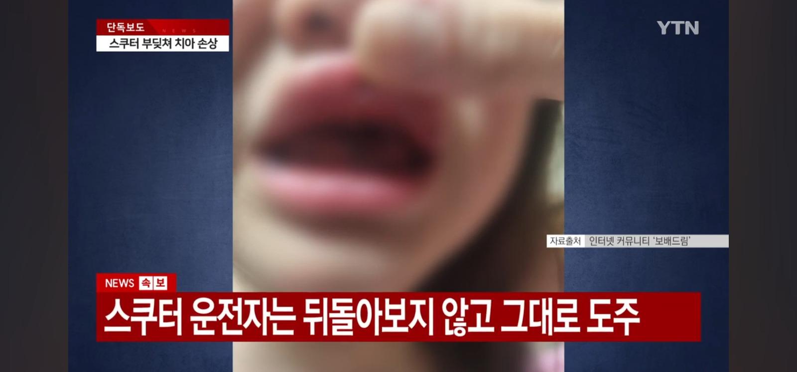 9살여아 뺑소니범 잡혔네요 (보배 베스트글) (9)