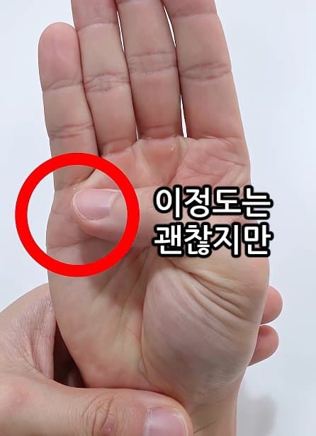 긴급) 지금 이동작 안되면 바로 병원에 가야 합니다! (28)