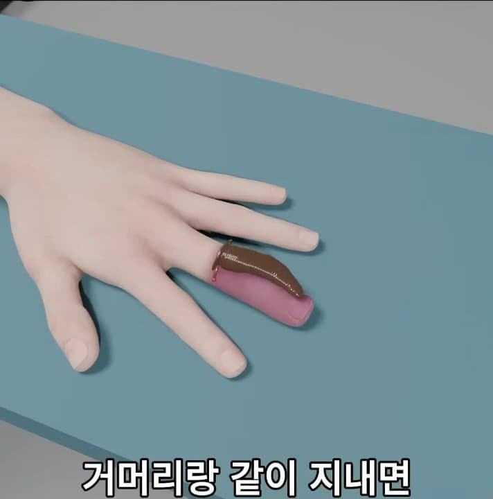 싱글벙글 손가락이 잘렸을 때 대처법 (47)