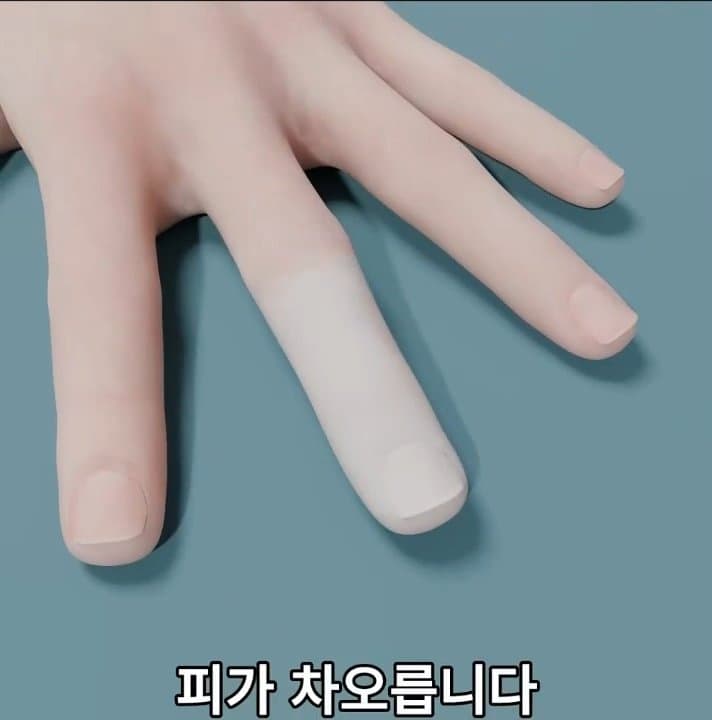 싱글벙글 손가락이 잘렸을 때 대처법 (32)