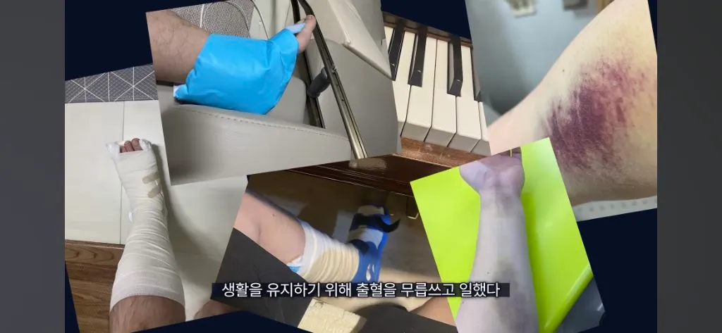 주사약 없이는 살 수 없는 몸으로 여행하는 유튜버