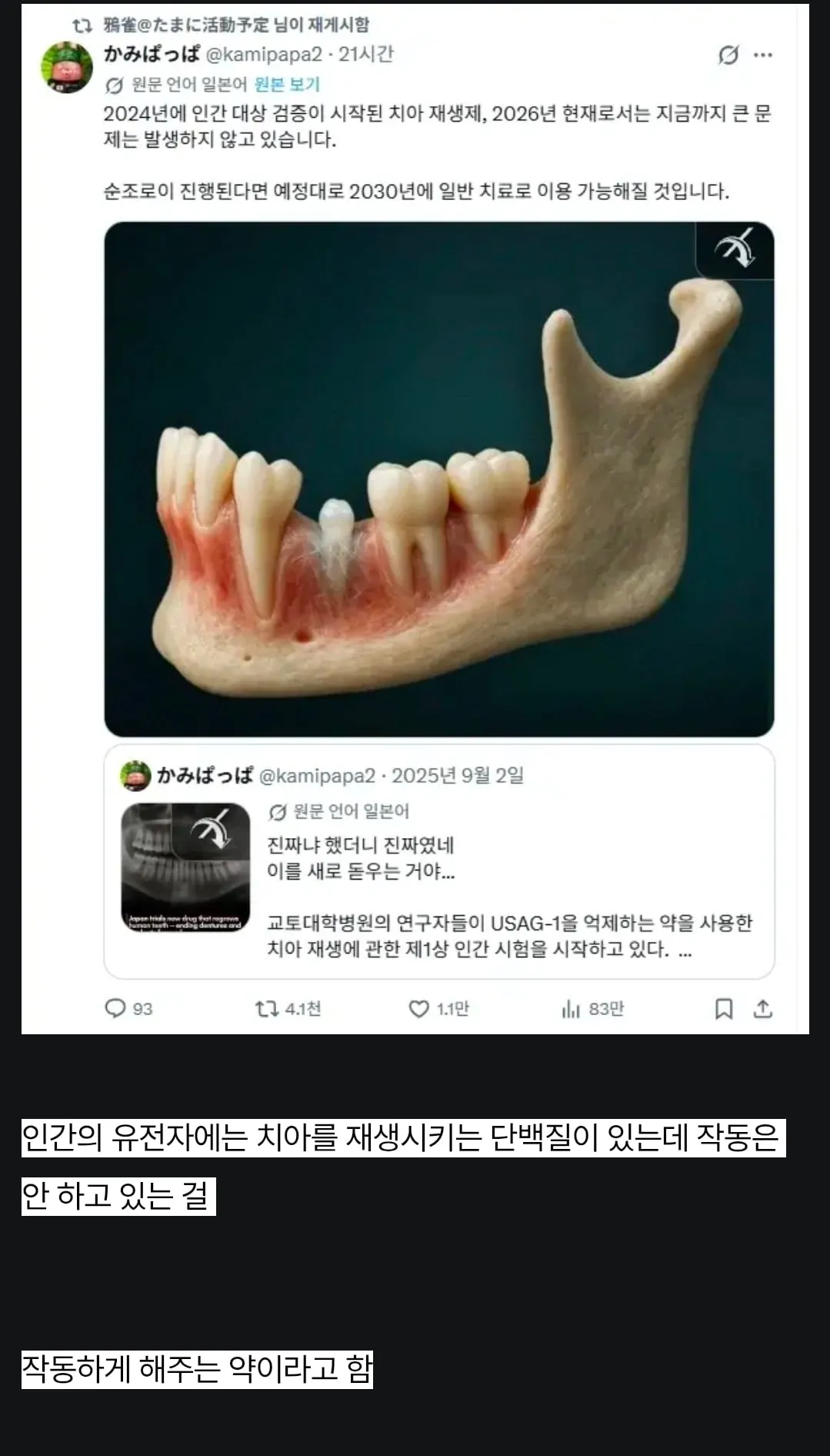 치아 재생 근황